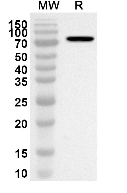 Anti-FKBP4 Polyclonal Antibody binds to Recombinant Human FKBP4, N-GST in WB Assay