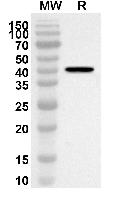 Anti-FOXO1 Polyclonal antibody binds to Recombinant Human FOXO1, N-His in WB Assay