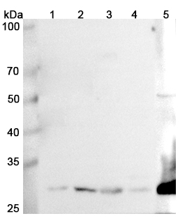 Anti-GCLM Polyclonal antibody binds to Recombinant Human GCLM, N-His in WB Assay