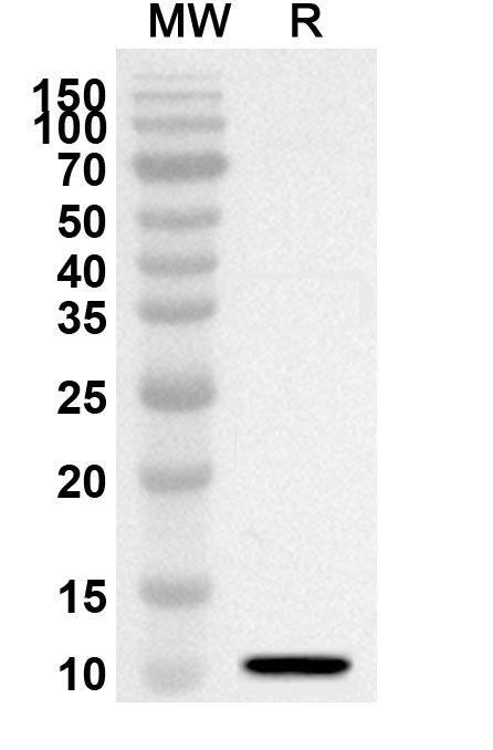 Anti-GNRH1 Polyclonal antibody binds to Recombinant Human GNRH1, N-His in WB Assay