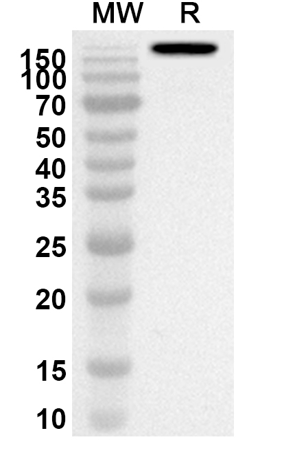 Anti-Golimumab Polyclonal Antibody in WB Assay
