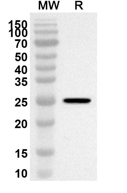 Anti-GP2 Polyclonal antibody binds to Recombinant Human GP2, N-His in WB Assay