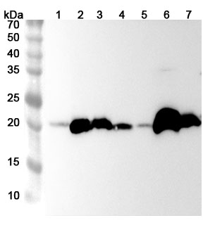 Anti-GPX1 Polyclonal antibody binds to Recombinant Human GPX1, N-His in WB Assay
