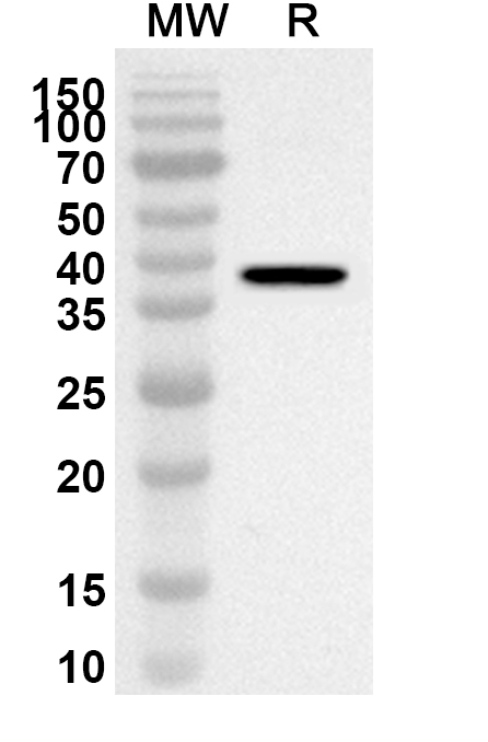 Anti-GPX4 Polyclonal antibody binds to Recombinant Human GPX4, N-GST in WB Assay