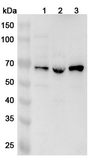 Anti-GTF2F1 Polyclonal Antibody binds to Recombinant Human GTF2F1 Protein, N-His in WB Assay