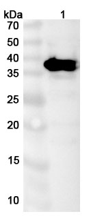 Anti-HAdV-5 E1B-55K/E1B-495R Polyclonal Antibody in WB Assay