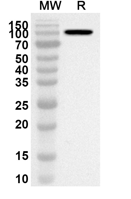 Anti-HAdV-5 L3/CP-H/Protein II Polyclonal Antibody binds to Recombinant Human adenovirus 5/HAdV-5 L3/CP-H/Protein II Protein, N-His in WB Assay