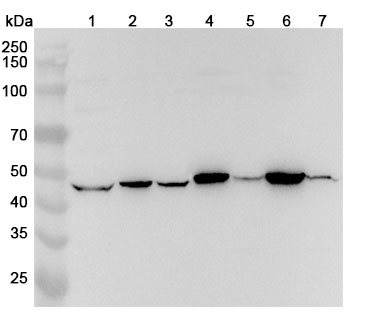 Anti-HAT1 Polyclonal Antibody binds to Human HAT1 Recombinant Protein, N-His in WB Assay