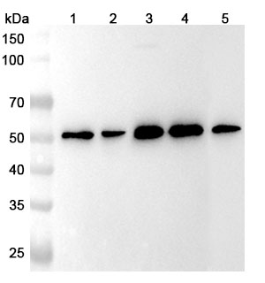 Anti-HNRNPLL Polyclonal Antibody binds to Mouse HNRNPLL Recombinant Protein, N-GST & C-His in WB Assay