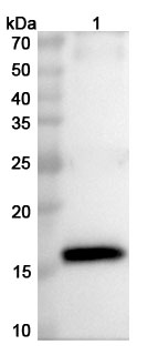 Anti-HPV18 E7/Protein E7 Polyclonal Antibody in WB Assay