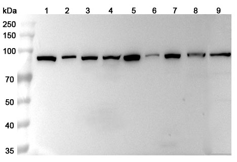 Anti-HSP90AA1 Polyclonal Antibody binds to Recombinant Human HSP90AA1 Protein, N-GST & C-His in WB Assay