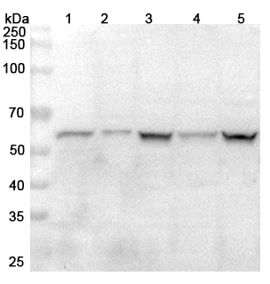 Anti-HSPA14 Polyclonal antibody binds to Recombinant Human HSPA14, N-His in WB Assay