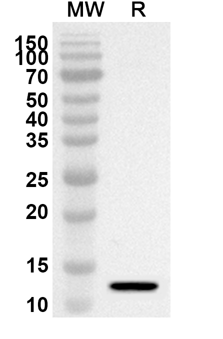 Anti-HSPA2 Polyclonal Antibody binds to Recombinant Human HSPA2, N-His in WB Assay