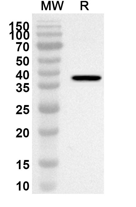 Anti-Human AATF Polyclonal Antibody binds to Recombinant Human AATF Protein, N-GST & C-His in WB Assay