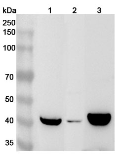 Anti-Human ABHD2 Polyclonal Antibody binds to Recombinant Human ABHD2 Protein, N-His in WB Assay