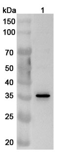 Anti-Human ACOT8 Polyclonal Antibody binds to Recombinant Human ACOT8 Protein, N-His in WB Assay