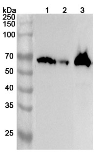 Anti-Human ACSM3 Polyclonal Antibody binds to Recombinant Human ACSM3 Protein, N-His in WB Assay