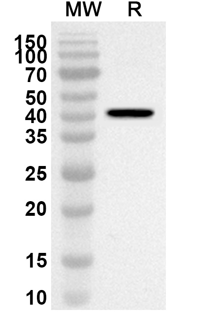Anti-Human ACSS2 Polyclonal Antibody binds to Recombinant Human ACSS2 Protein, N-His in WB Assay