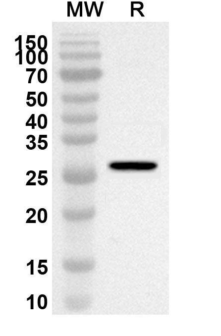 Anti-Human ACTN1 Polyclonal Antibody binds to Recombinant Human ACTN1 Protein, N-His in WB Assay