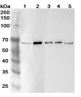 Anti-Human ADAM8 Polyclonal Antibody in WB Assay