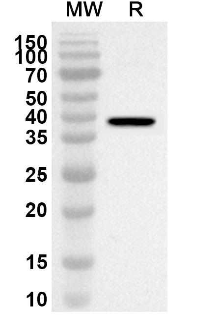 Anti-Human ADRA2C Polyclonal Antibody binds to Recombinant Human ADRA2C Protein, N-His-KSI in WB Assay