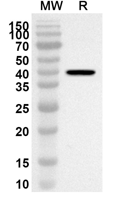 Anti-Human ADSL Polyclonal Antibody binds to Recombinant Human ADSL, N-His in WB Assay