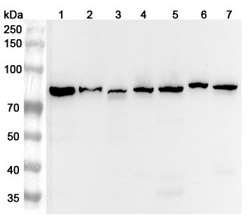 Anti-Human AFG3L2 Polyclonal Antibody binds to Recombinant Human AFG3L2 Protein, N-His in WB Assay