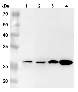 Anti-Human AGR3 Polyclonal Antibody binds to Mouse AGR3 Recombinant Protein, C-His in WB Assay