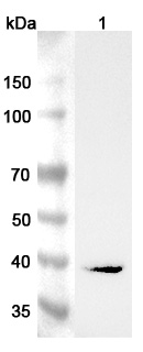 Anti-Human AGXT Polyclonal Antibody binds to AGXT, N-His, recombinant protein in WB Assay