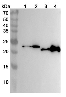 Anti-Human AK1/Adenylate kinase isoenzyme 1 Polyclonal Antibody binds to Recombinant Human AK1 Protein, N-His in WB Assay