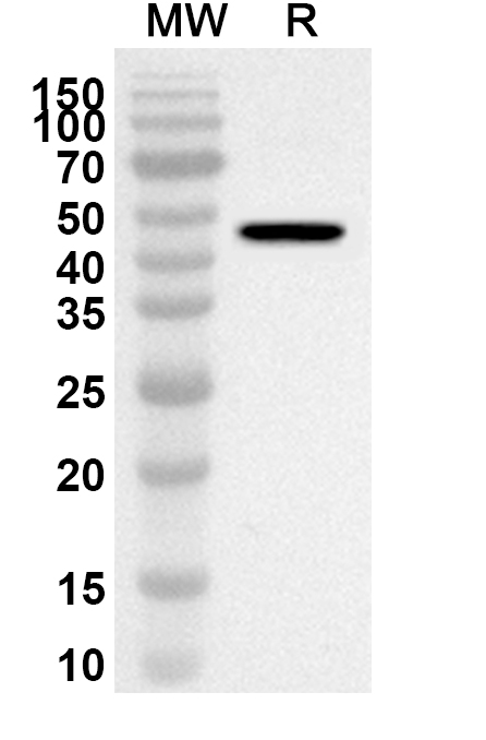 Anti-Human ALDH1A2 Polyclonal Antibody binds to Recombinant Human ALDH1A2, N-His in WB Assay