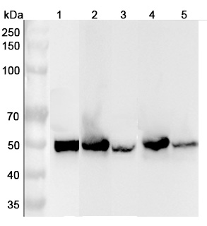 Anti-Human ALDH1A3 Polyclonal Antibody binds to Recombinant Human ALDH1A3 Protein, N-His in WB Assay