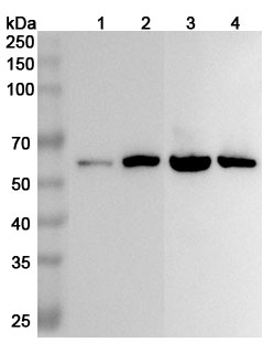 Anti-Human ALDH7A1 Polyclonal Antibody binds to Recombinant Human ALDH7A1, N-His in WB Assay
