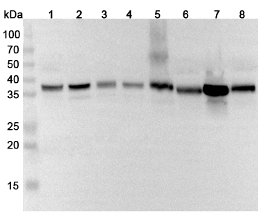 Anti-Human ALDOC Polyclonal Antibody binds to Recombinant Human ALDOC, N-His in WB Assay