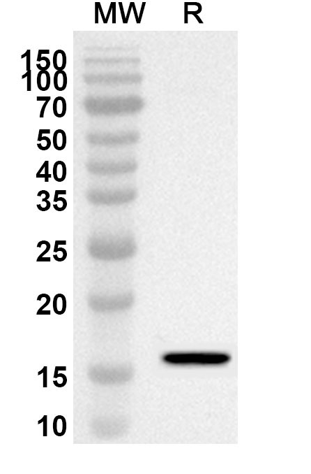 Anti-Human AMOT Polyclonal Antibody binds to Recombinant Human AMOT Protein, N-His in WB Assay