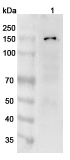 Anti-Human ANO1 Polyclonal Antibody binds to Recombinant Human ANO1 Protein, N-His in WB Assay