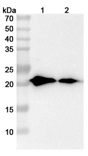 Anti-Human AP1S2 Polyclonal Antibody binds to Recombinant Human AP1S2, N-His in WB Assay