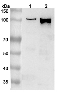 Anti-Human AP2A1 Polyclonal Antibody binds to Recombinant Human AP2A1 Protein, N-His in WB Assay