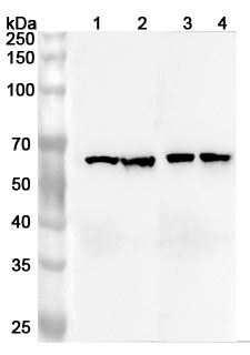 Anti-Human ARFGAP3 Polyclonal Antibody binds to Recombinant Human ARFGAP3 Protein, N-His in WB Assay