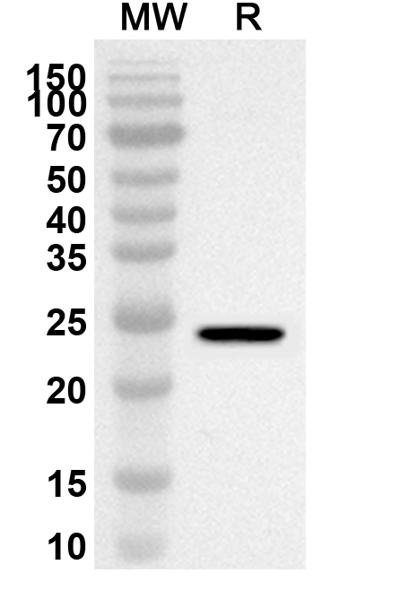 Anti-Human ASH2L Polyclonal Antibody binds to Recombinant Human ASH2L Protein, N-His in WB Assay