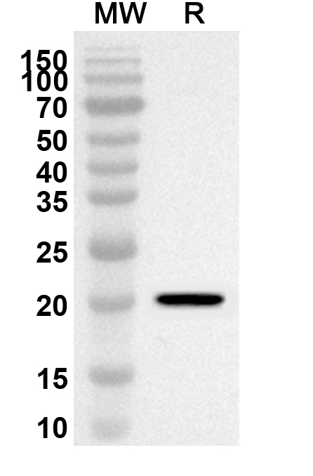 Anti-Human ATF6 Polyclonal Antibody binds to Recombinant Human ATF6 Protein, N-His-SUMO in WB Assay