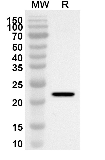 Anti-Human ATP10A Polyclonal Antibody binds to Recombinant Human ATP10A Protein, N-His in WB Assay