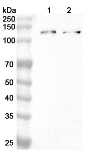 Anti-Human ATP13A1 Polyclonal Antibody binds to Recombinant Human ATP13A1 Protein, N-His in WB Assay