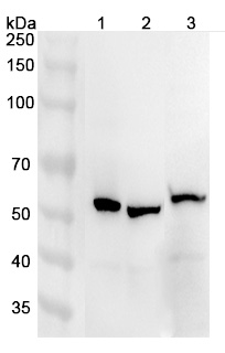 Anti-Human ATP6V1B1 Polyclonal Antibody binds to Recombinant Human ATP6V1B1 Protein, N-His in WB Assay