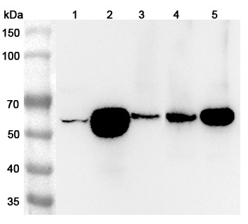 Anti-Human ATP6V1B2 Polyclonal Antibody binds to Recombinant Human ATP6V1B2 Protein, N-His in WB Assay