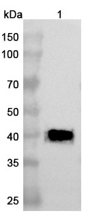 Anti-Human ATP7B VHH (SAA1241) binds to ATP7B, N-His, recombinant protein in WB Assay