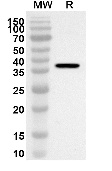 Anti-Human BAMBI Polyclonal Antibody binds to Recombinant Human BAMBI, N-GST in WB Assay