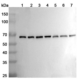 Anti-Human BECN1 Polyclonal Antibody binds to Recombinant Human BECN1 Protein, N-His in WB Assay