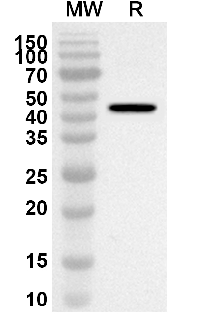 Anti-Human BORCS5 Polyclonal Antibody binds to Recombinant Human BORCS5 Protein, N-GST & C-His in WB Assay