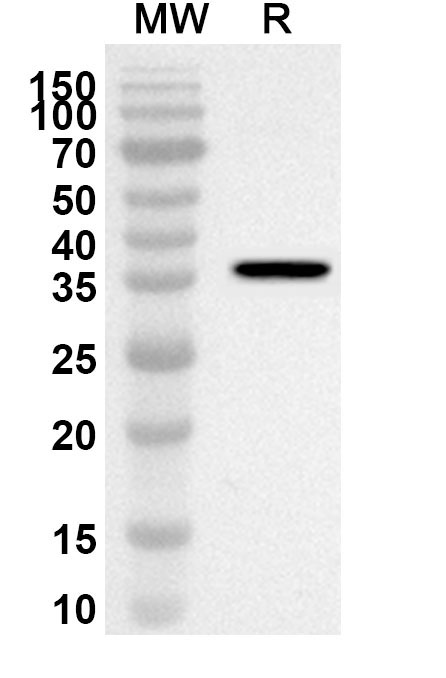 Anti-Human BPNT1 Polyclonal Antibody binds to Recombinant Human BPNT1 Protein, N-His in WB Assay